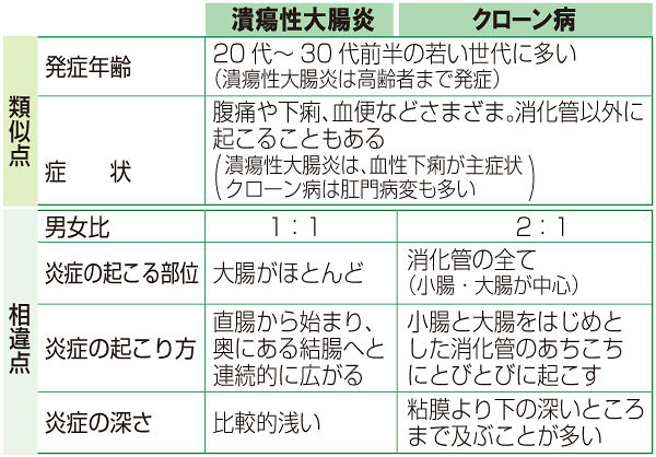 (中) 潰瘍性大腸炎とクローン病の類似点と相違点 (中) 潰瘍性大腸炎とクローン病の類似点と相違点