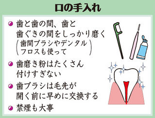 注意点 口の手入れ 注意点 口の手入れ