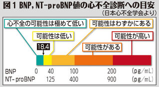 (中)図1 BNP,NT-proBNP値の心不全診断への目安 (中)図1 BNP,NT-proBNP値の心不全診断への目安